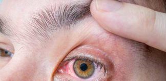 Czerwone oczy okulista warszawa